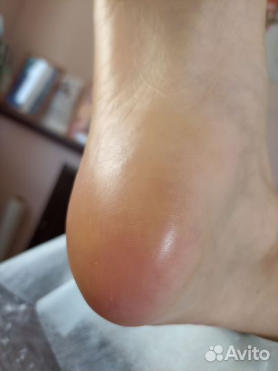 Смарт педикюр