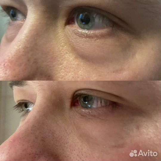 Классический массаж