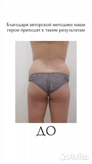 Ультразвуковая Кавитация,быстрое похудение