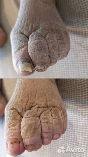 Услуги подолога