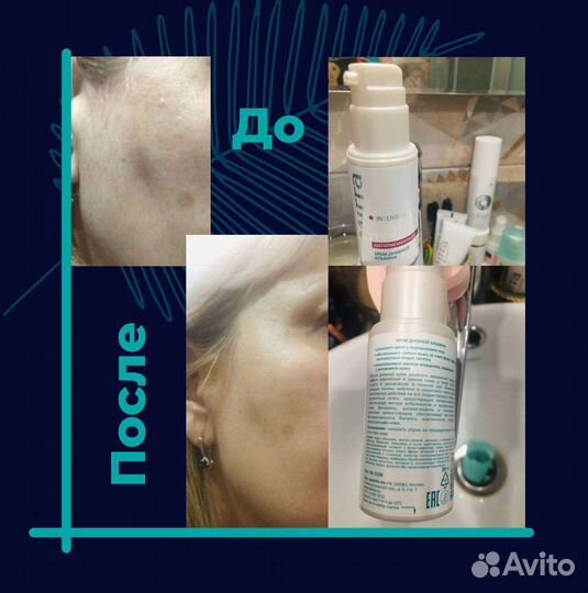 Крем от пигментации. Мирра Люкс