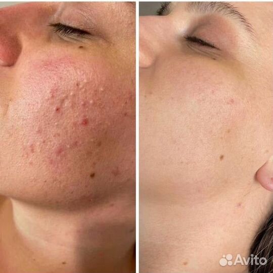 Косметолог на с/з