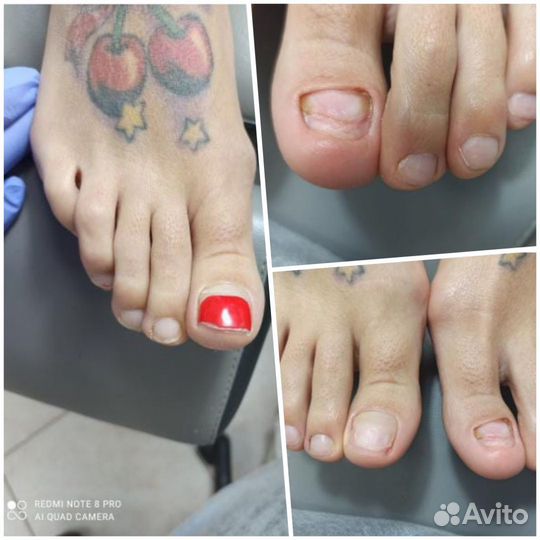 Услуги подолога с выездом. Педикюр пожилым людям