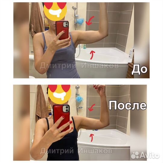 Лимфодренажный массаж