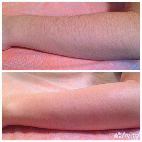 Депиляция Парафинотерапия рук и ног