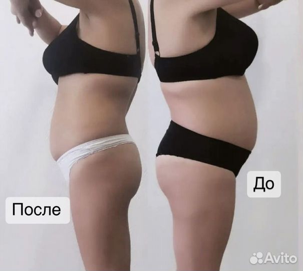 Мадеротерапия