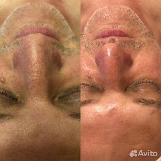 Услуги косметолога