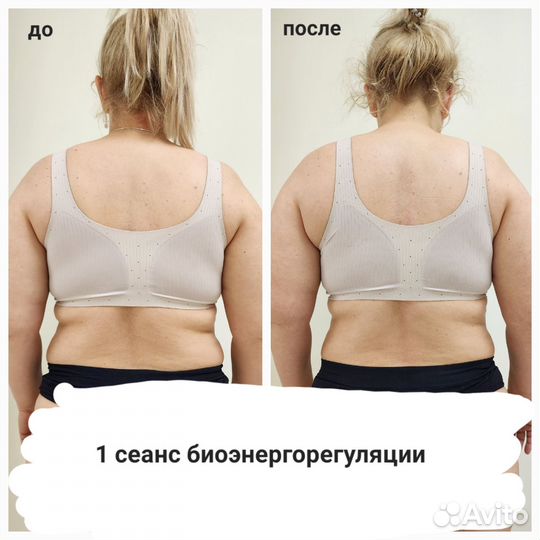 Массаж, коррекция осанки (сколиоз, кифоз, лордоз)