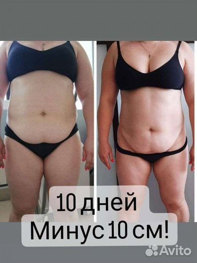 Криолиполиз