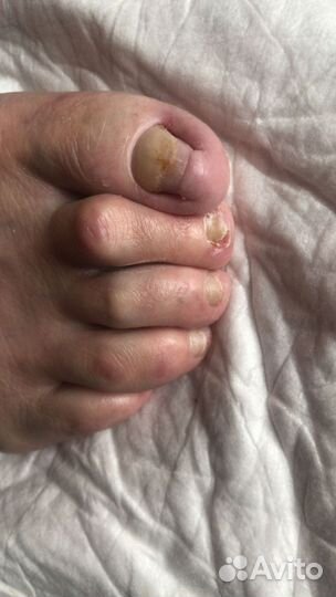 Педикюр старикам выезд на дом