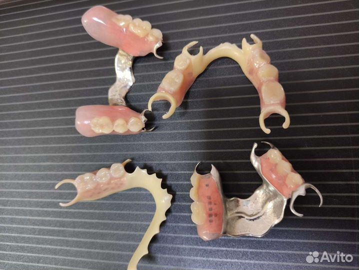 Ремонт зубных протезов