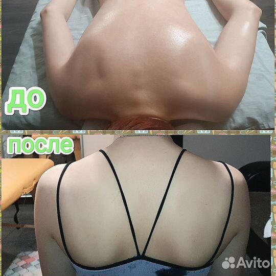 Мануальная процедура Высшей категории, массаж