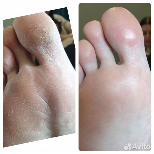 Педикюр,выезд на дом