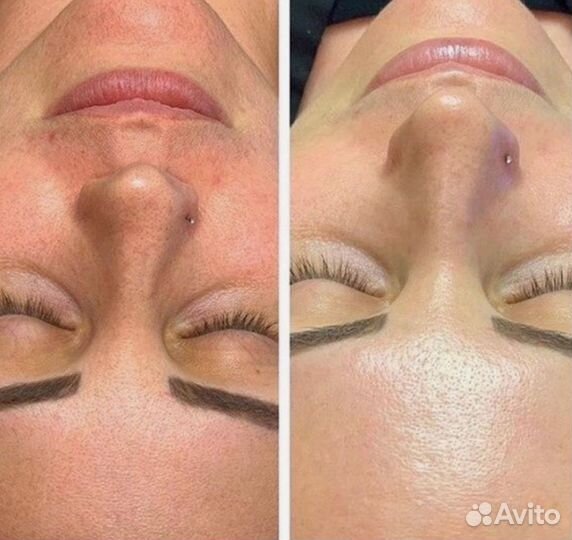 Скульптурный массаж, классический лица