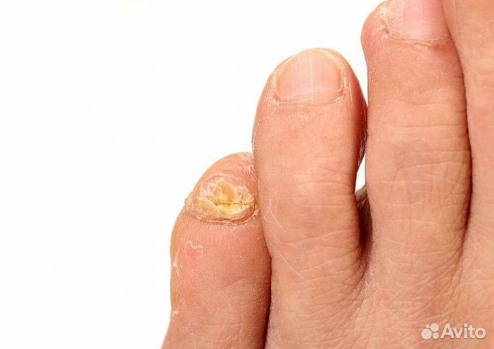 Педикюр маникюр