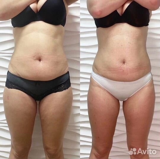 Массаж на дому. Ладожская