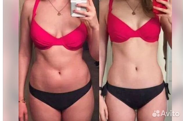 Плоский живот - размер за 1 процедуру в Перми