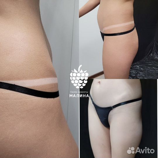 Моментальный спрей- загар