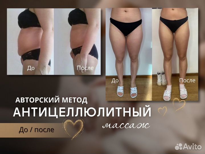 Антицеллюлитный массаж