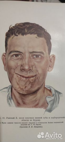 Опыт советской медицины