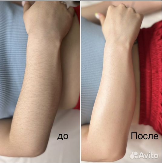 Депиляция воском