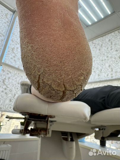 Мастер педикюра. подолог на дом