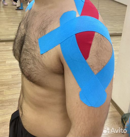 Тейпирование/ тейп