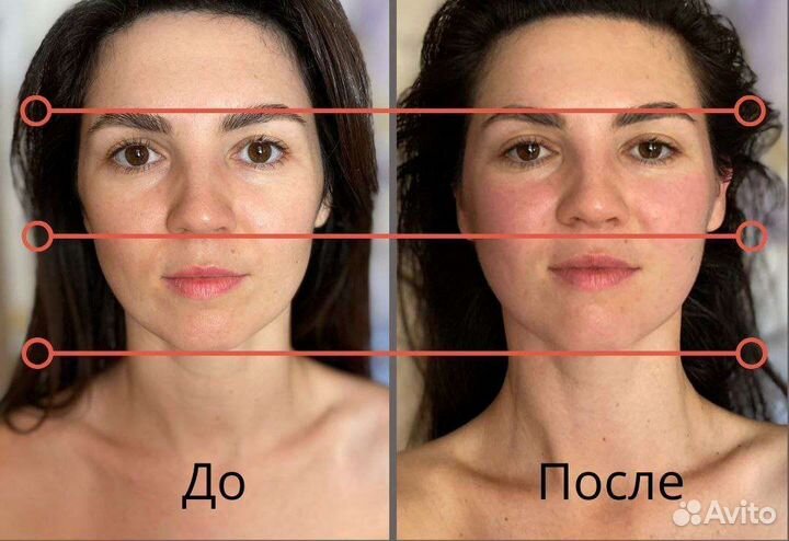 Другой массаж лица