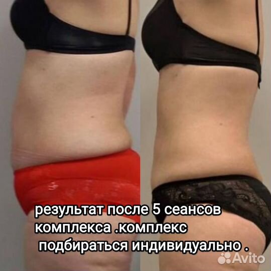 Вакуумный массаж,кавитация