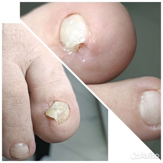 Маникюр и педикюр подолог