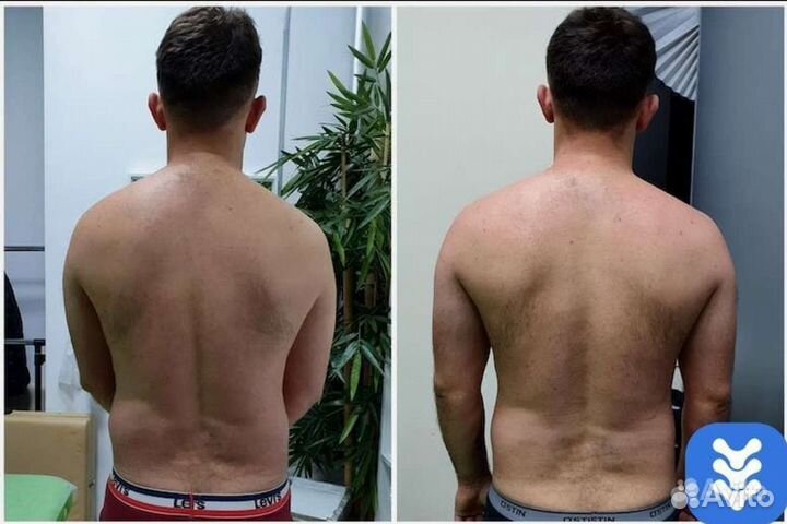 Массаж мануальный костоправ