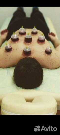 Хиджама (обучение)