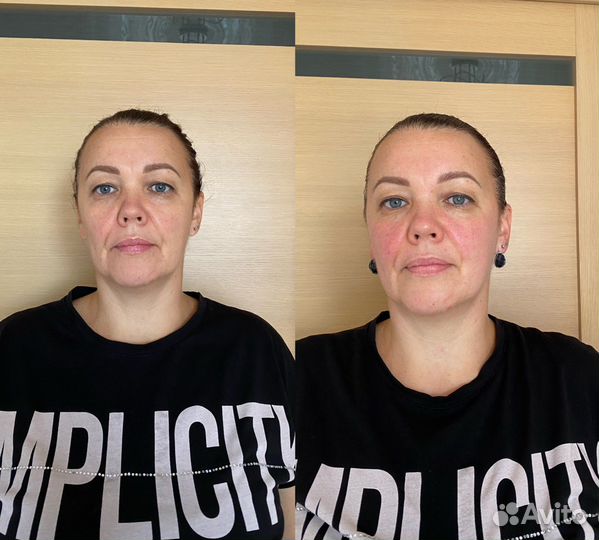 Массаж лица