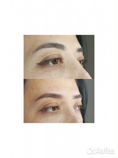 Перманентный макияж и удаление