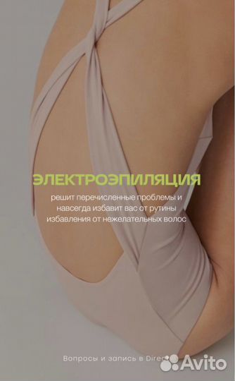 Электроэпиляция