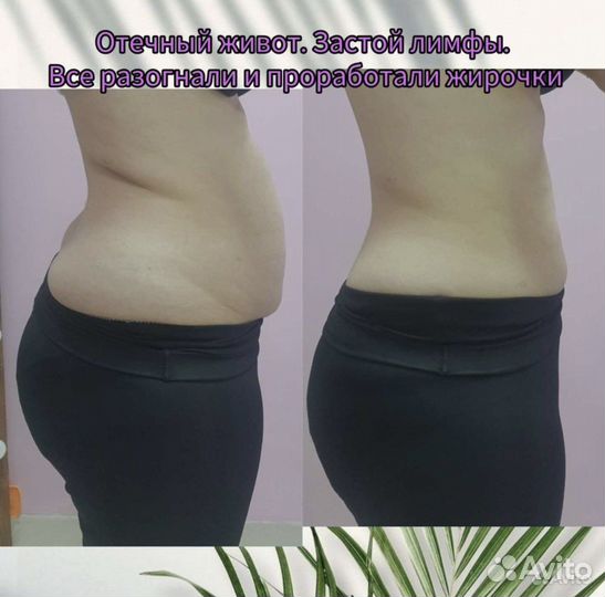 Массаж коррекция фигуры. Похудение