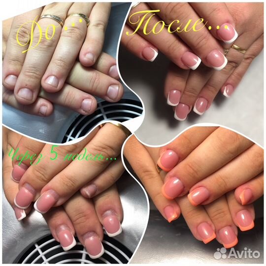 Наращивание ногтей,маникюр, гель-лак, педикюр