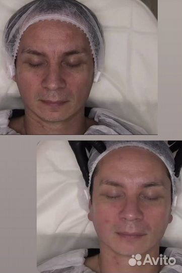 Консультация косметолога