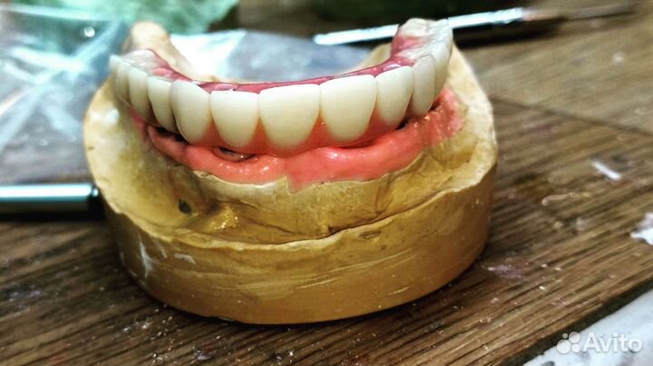 Зубной техник съемное протезирование