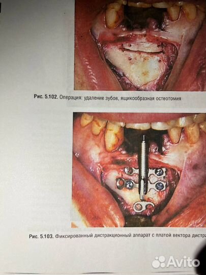 Дентальная имплантация учебная литература