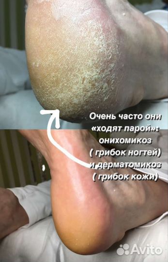 Подолог(решение проблем), педикюр