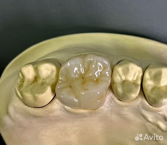 Услуги зубного техника