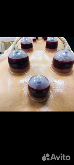 Хиджама (обучение)