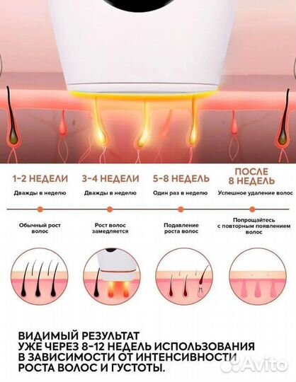 Фотоэпилятор лазерный для лица и тела IPL