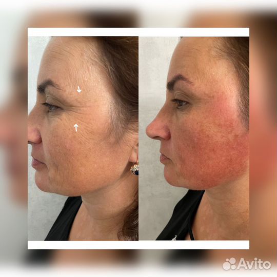 Массаж всего тела