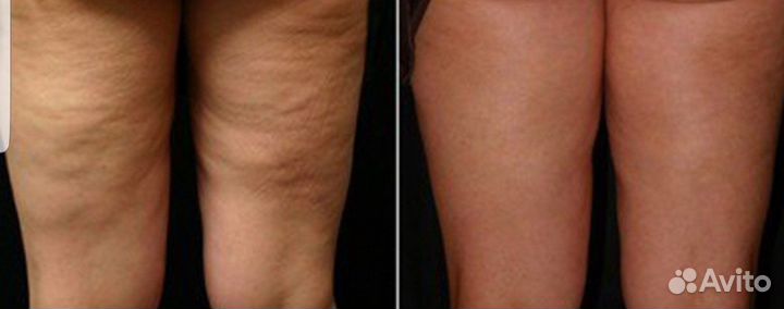 Услуги массажиста