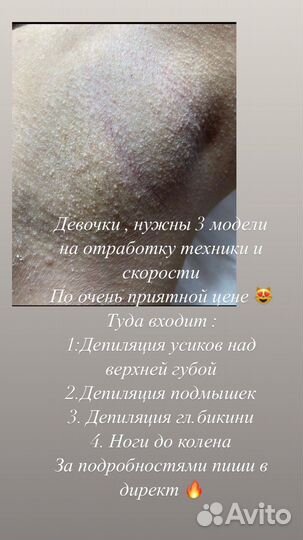 Депиляция воском