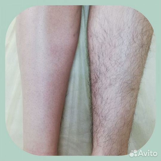 Депиляция Косметолог Массаж лица 7 видов