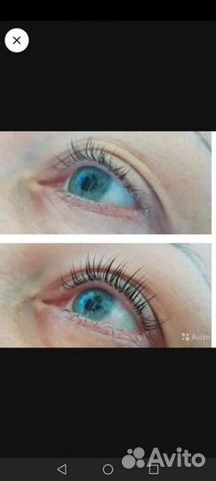 Услуги косметолога