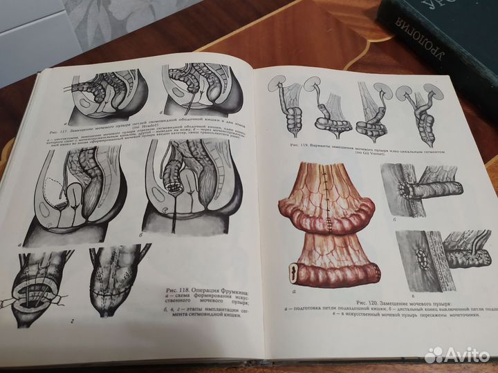 Атлас урогинекологических операций